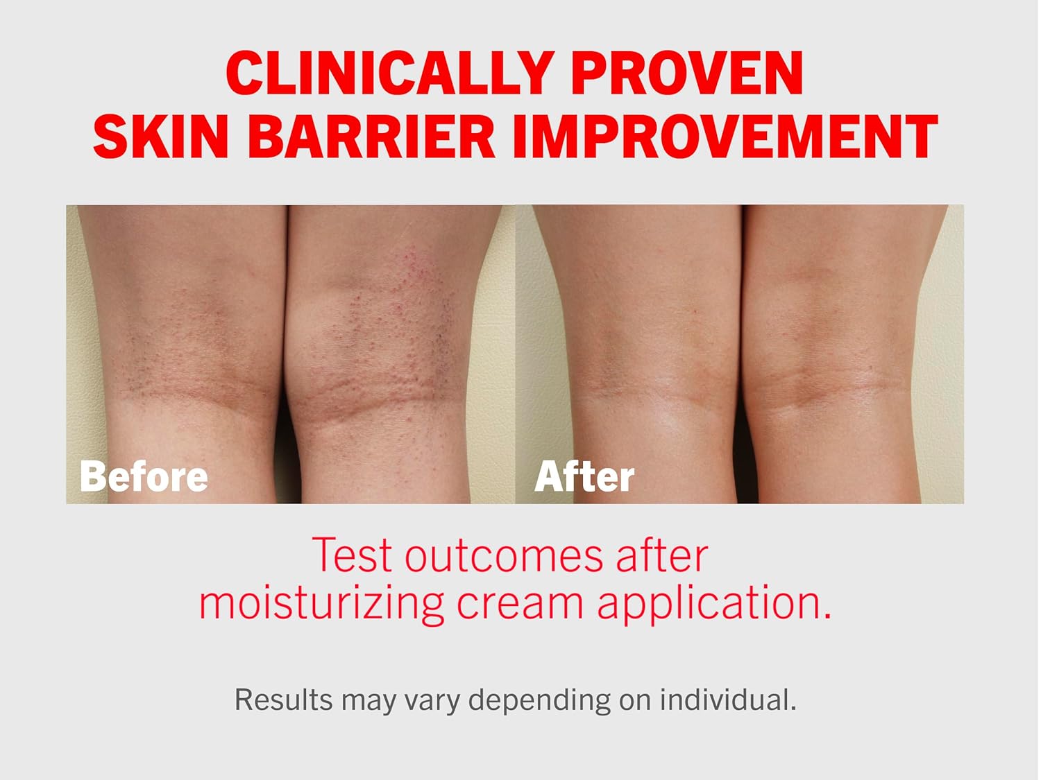 Atopalm | Intensive Moisturizing Cream | Face & Body Moisturizer | For Dry & Sensitive Skin | Paraben-Free Lotion | Replenishes Hydration | Skin Barrier Repair | Korean Skin Care | 3.4 Fl Oz (100Ml) : Beauty & Personal Care