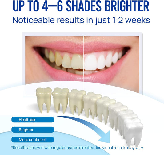 Viebeauti Teeth Whitening Pen Gel: No Sensitivity With Remineralizing Pen, Carbamide Peroxide Removes