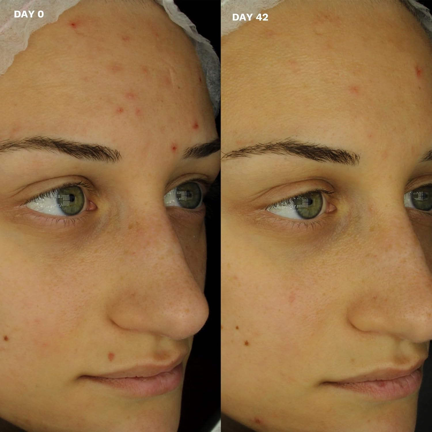 Ameliorate Clarifying Facial Tonic 200ml | Lab6, Nicinamide| Dermatologically tested : Amazon.co.uk: Beauty
