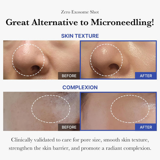Medicube Flawless Skin: Deep Vitamin C Golden Capsule Face Moisturizer And Zero Exosome Shot 7,500 Ppm Spicule Facial Serum