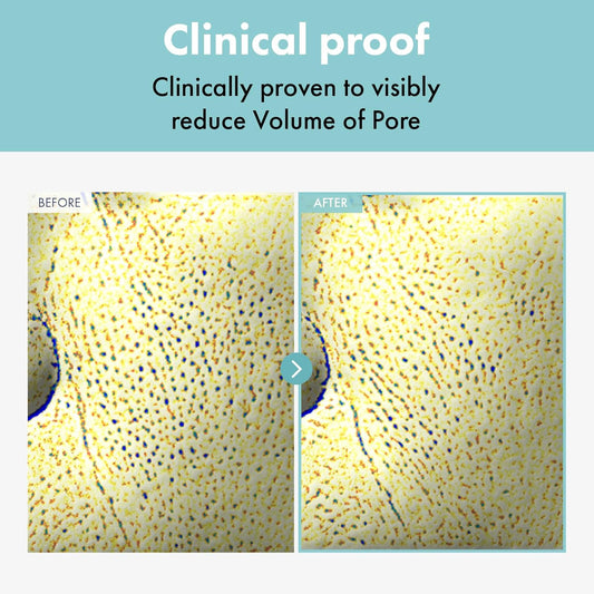 Ovalicin Skin Clear Cream, Skin Soothing, Moisturizing With Niacinamide And Sulfur, Korean Skincare, 50G, 1.76 Oz