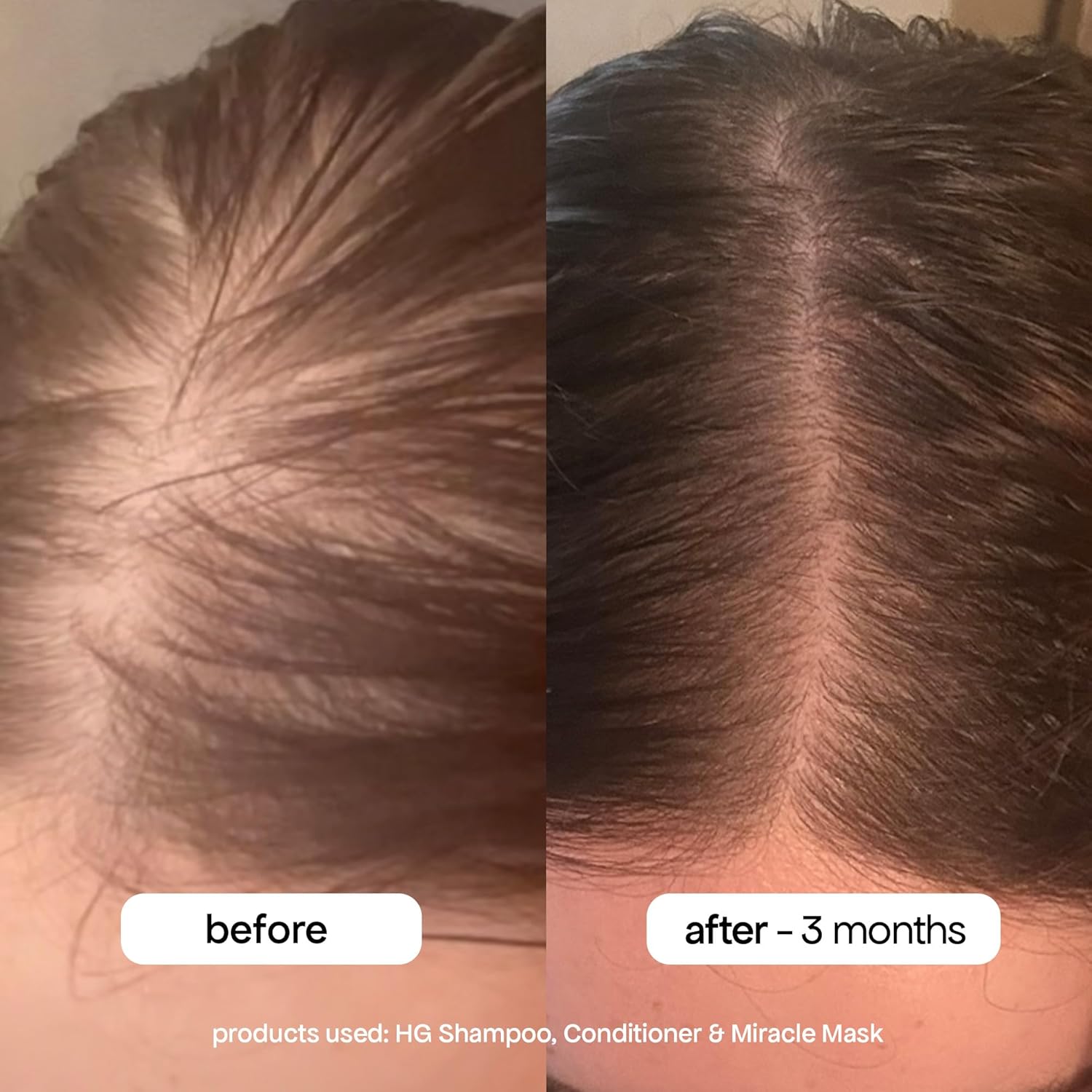Bondiboost Hg Miracle Hair Mask - Deep-Conditioning, Silicone-Free Treatment With Argan & Jojoba Oils For Hydrated, Silky, Frizz-Free Hair - Vegan & Cruelty-Free, 200Ml