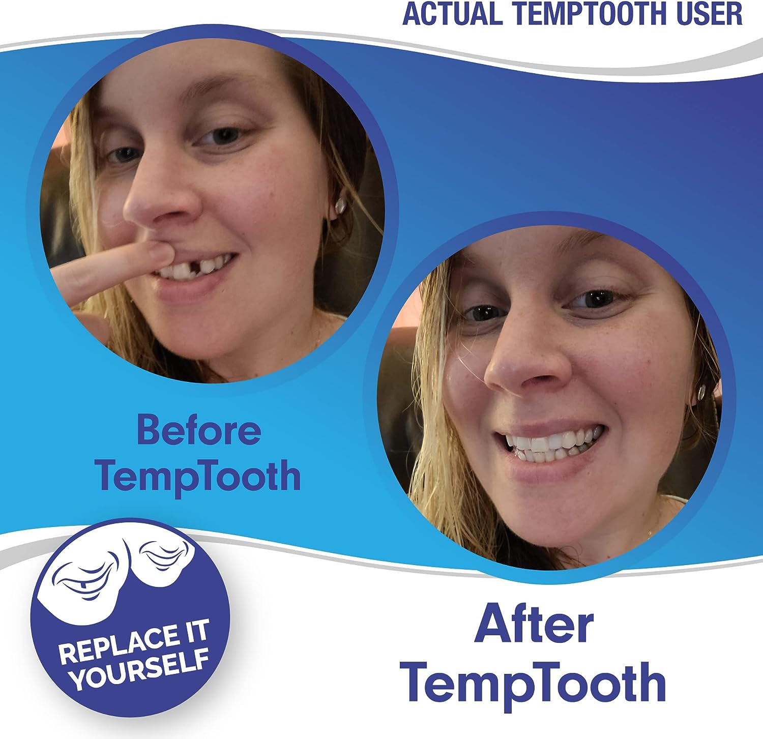 Temptooth #1 Seller Trusted Patented Temporary Tooth Replacement Product : Health & Household