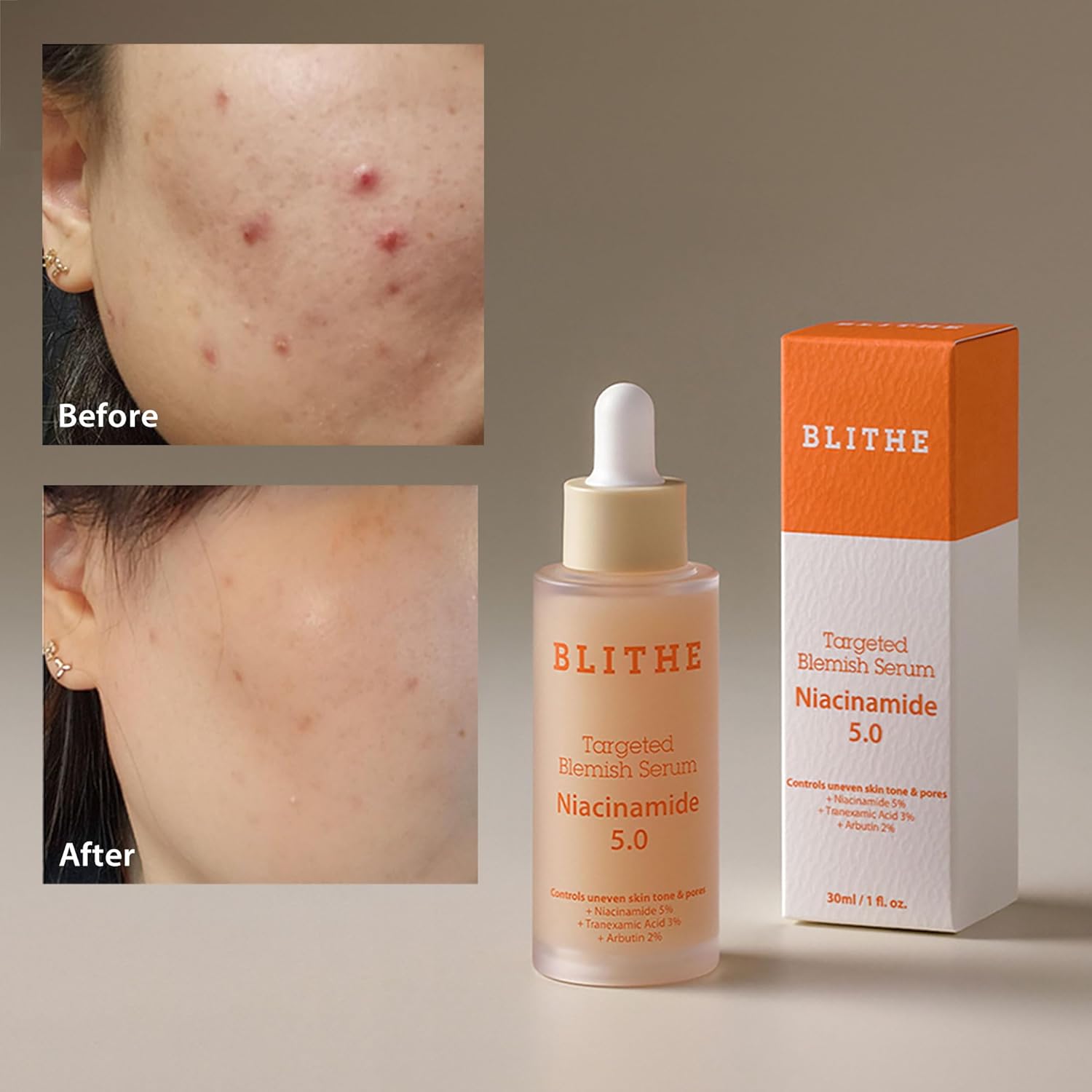 Blithe Dark Spot Corrector & Tightening Serum Bundle Set, Niacinamide 5% And Pressed Serum Tundra Chaga, Best Korean Skincare : Beauty & Personal Care