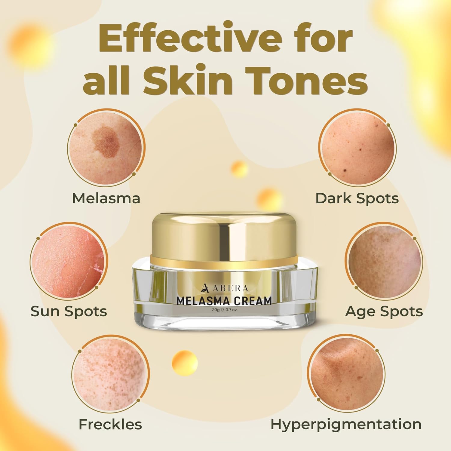 Abera Melasma Cream (Premium Version) - Cream For Face Treatment, Cream For Hydrating To Plump And Repair Dry Skin, Safe For Sensitive Skin