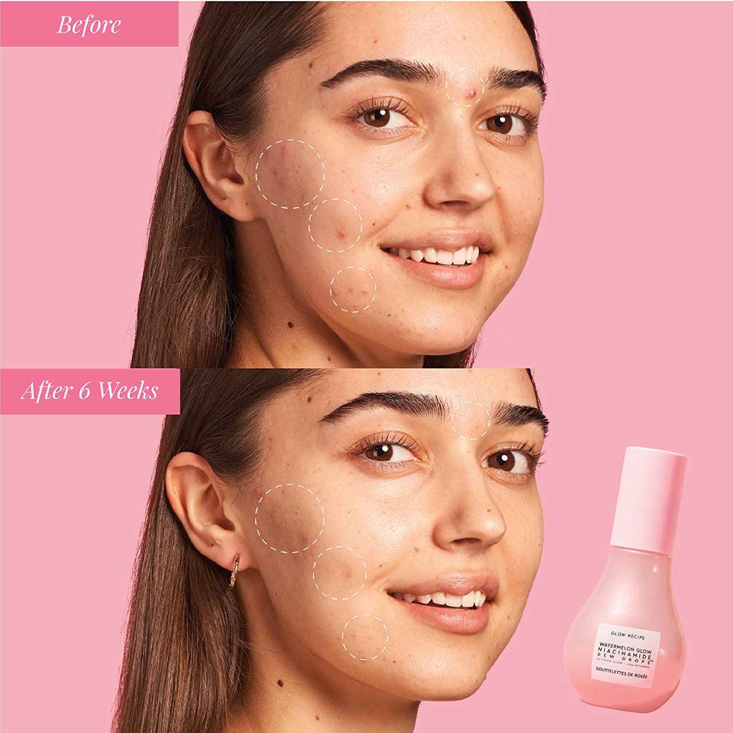 Glow Recipe Watermelon Glow Niacinamide Dew Drops Face Serum - Hydrating Hyaluronic Acid Skincare Serum, Makeup Primer & Liquid Highlighter for Dewy, Glowing Skin - Brightening Face Serums (40ml) : Beauty & Personal Care