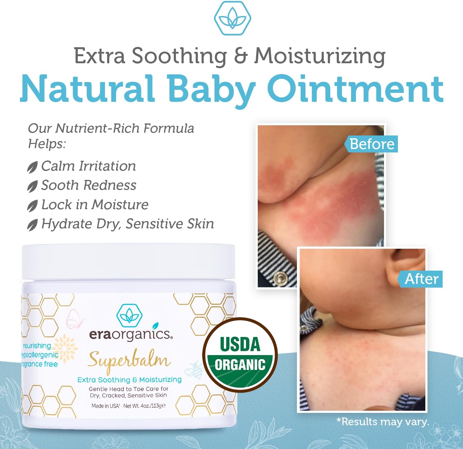 Era Organics Healing Ointment for Babies - USDA Certified Organic Natural Gentle Moisturizer for Sensitive Skin Prone To Baby Eczema, Cradle Cap (Infant Seborrheic Dermatitis), Rashes & Hives (4 oz.) : Baby