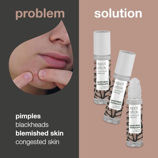 Australian Bodycare Tea Tree Oil Spot Stick - Tea Tree Blemish Stick For Spots, Pimples, Oily And Acne Prone Skin. Contains High Pharmaceutical Grade Australian Tea Tree Oil, 9Ml (3 X Spot Stick)