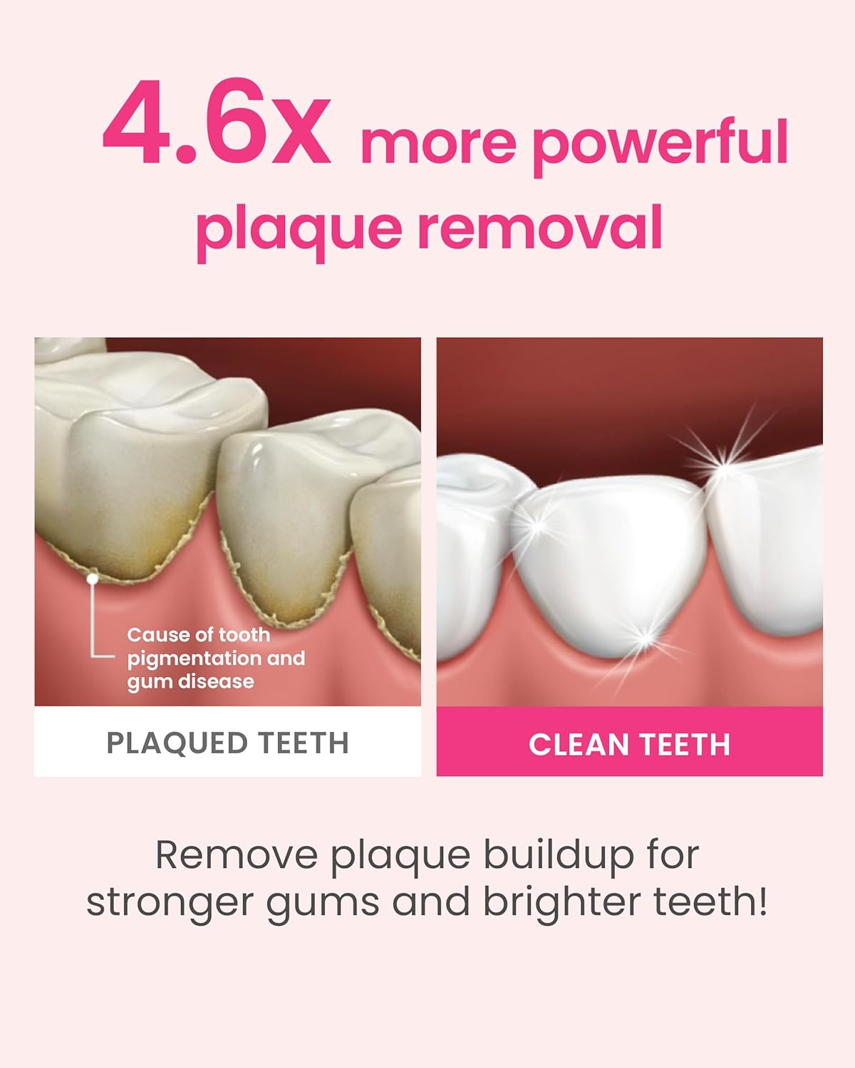 Euthymol Whitening Toothbrush (Pink, 6 Count) - Premium Soft Dual-Tension Bristles. Advanced Plaque Removal, Stain Reduction. : Amazon.co.uk: Health & Personal Care