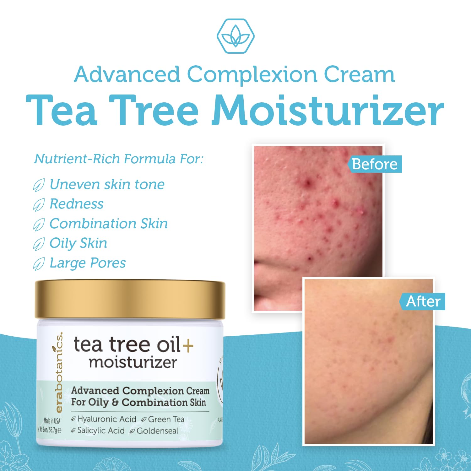 Era Organics Tea Tree Cream Face Moisturizer for Oily Skin - Advanced 7X Balancing Oily Skin Moisturizer - Non-Greasy Moisturizer - Tea Tree Oil for Skin : Beauty & Personal Care