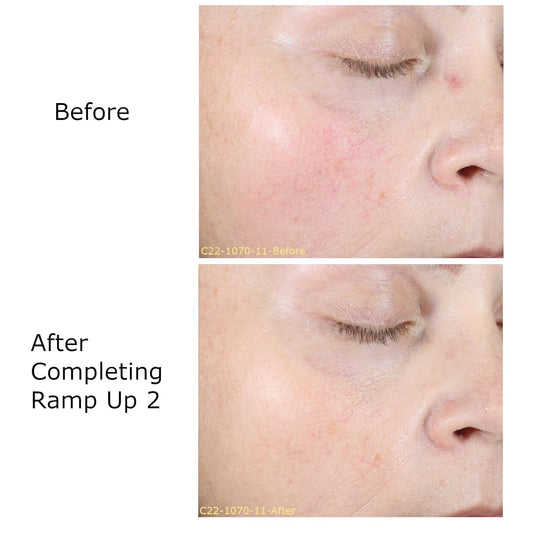 Rhr Overnight Mask, Skin Care Routine, Daily Face Moisturizer, Contains Hyaluronic Acid And Heptapeptides, For All Skin Type, Brighten & Rejuvenation *Activator Sold Separately