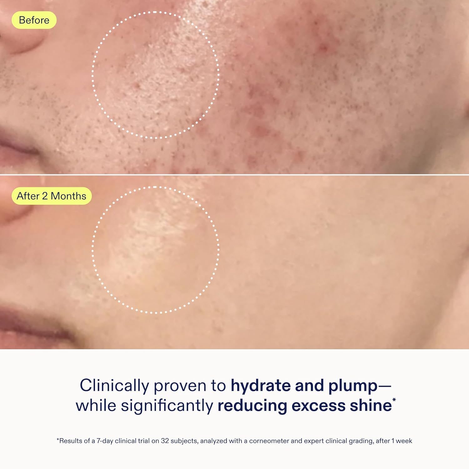 Skinfix Skin Barrier Restoring Gel Cream - 1.7 Oz Refill - Non-Greasy Moisturizer For Normal To Combination Skin - Hydrates, Plumps & Smooths - Non-Comedogenic, Fragrance Free, Vegan, Cruelty Free : Beauty & Personal Care