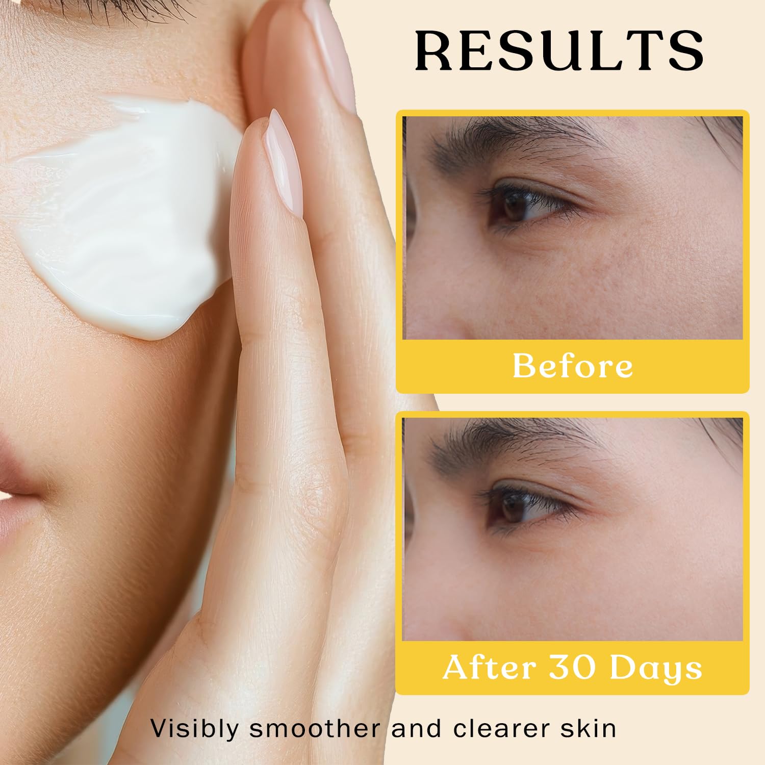 Brooksie Naturals Beef Tallow Sun Balm For Skin - Moisturizer Cream - 100% Grass Fed Whipped Beef Tallow - Herb Infused - Supports Eczema, Rosacea - Made In Usa - Unscented - 2 Oz : Beauty & Personal Care