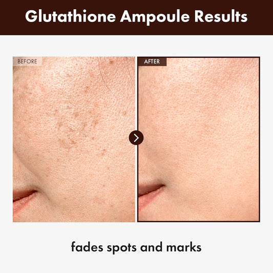 Glutathione Serum With 20,000Ppm Glutathione, Niacinamide And Hyaluronic Acid, Dark Spot, Improve Skin Elasticity, Revitalize Complexion, Korean Skincare, 30Ml, 1.01 Fl. Oz