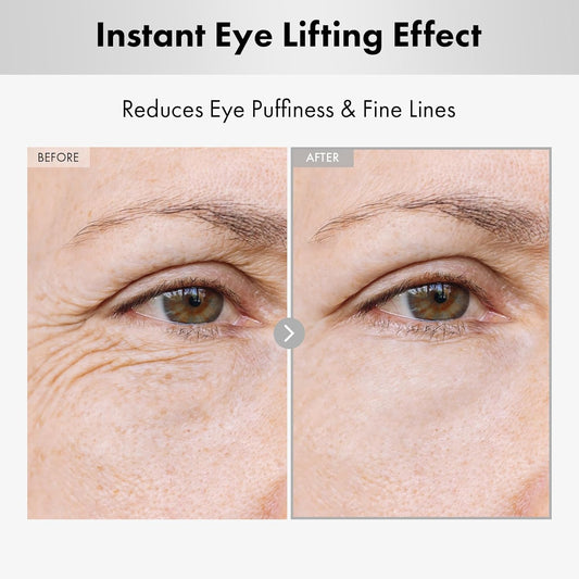 Hyaluron Lifting Eye Cream, Hyaluronic Acid, 5% Arbutin, Niacinamide For Puffy Eyes, Dark Spot And Fine Lines, Hydrating Under Eye Bag, Korean Skin Care, 15Ml, 0.5 Fl. Oz