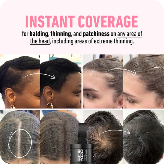 Boldify Hairline Powder + Hair Fiber: Bundle That Instantly Conceals Hair Loss Hair Powder For Thinning Hair, Root Cover Up (Black)