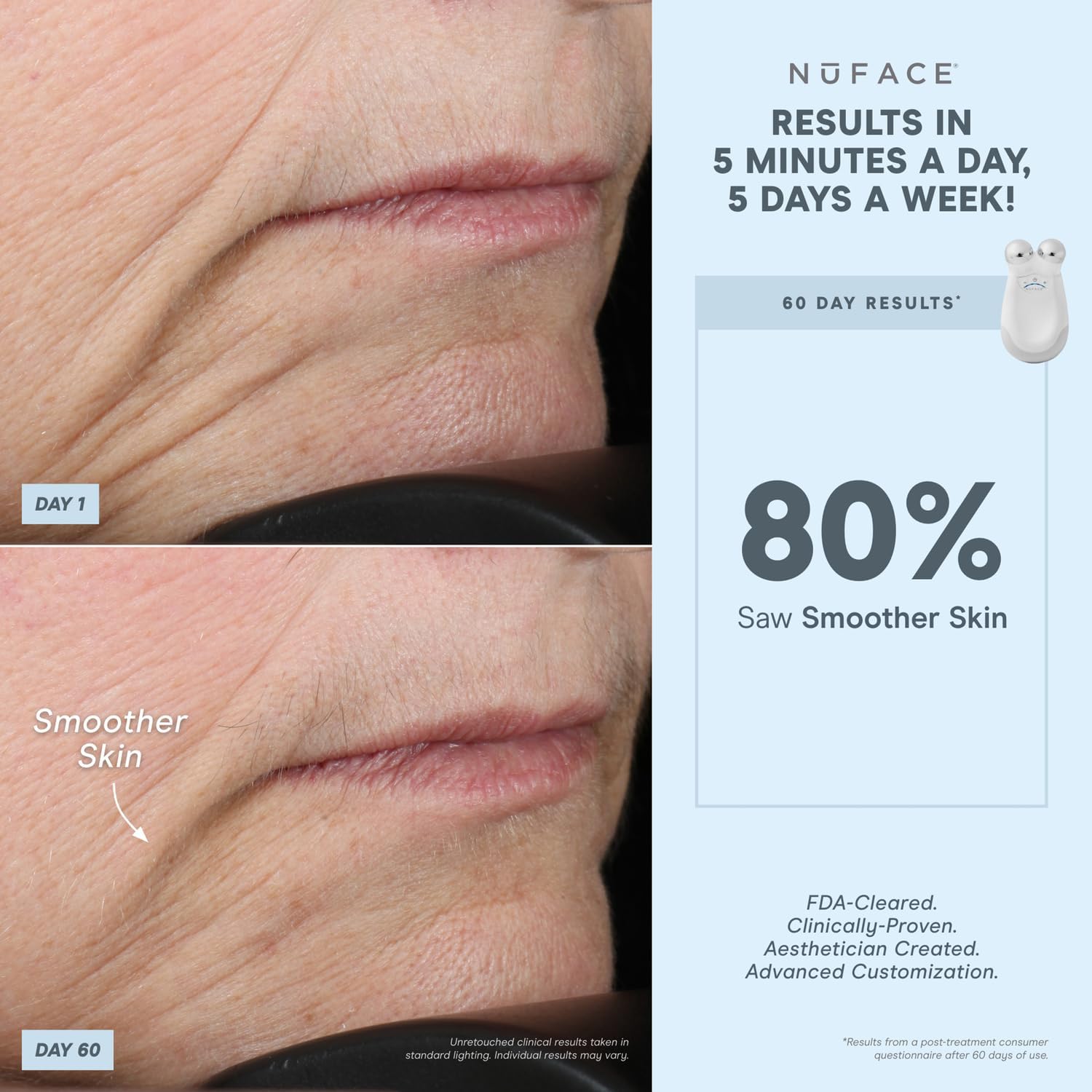 Nuface Effective Lip & Eye Attachment For Trinity Microcurrent Facial Device, Fda Cleared - Depuffing, Line Smoothing, Plumping & Tightening Treatment For Hard-To-Reach Areas Around Mouth And Eyes