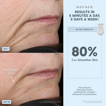Nuface Effective Lip & Eye Attachment For Trinity Microcurrent Facial Device, Fda Cleared - Depuffing, Line Smoothing, Plumping & Tightening Treatment For Hard-To-Reach Areas Around Mouth And Eyes