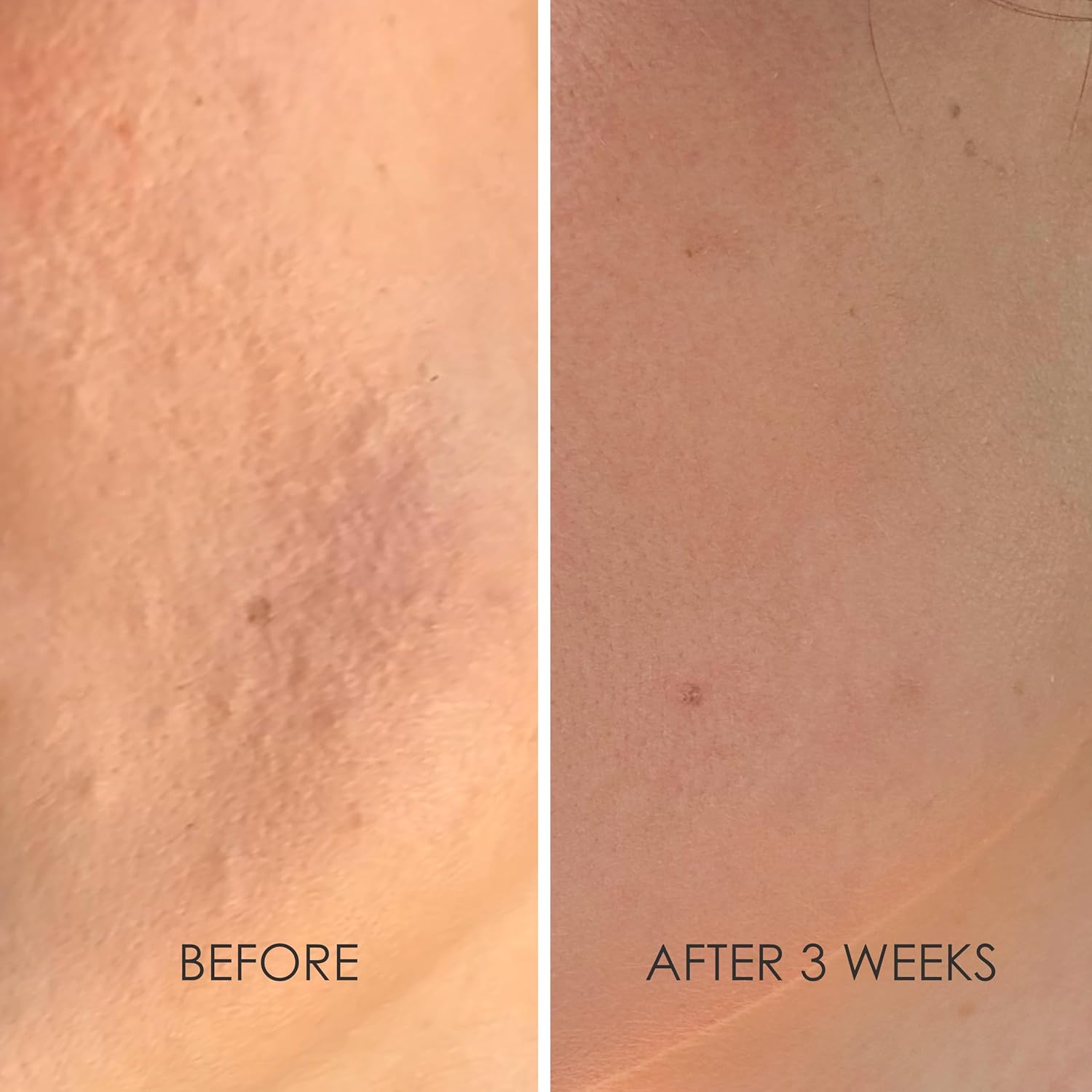 Reflekt 2 Collagen Boost Vitamin C Serum : Beauty & Personal Care