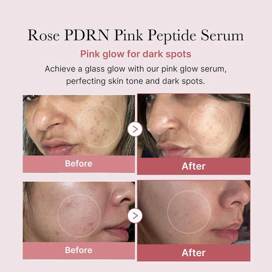 Medicube Rose Pdrn Pink Peptide Serum, Pink Glow Serum, Vegan Pdrn, Peptide, Niacinadmie, Hydrating & Moisturizing & Firming, Uneven Skin Tone, Pore Care, Korean Skincare, Vegan