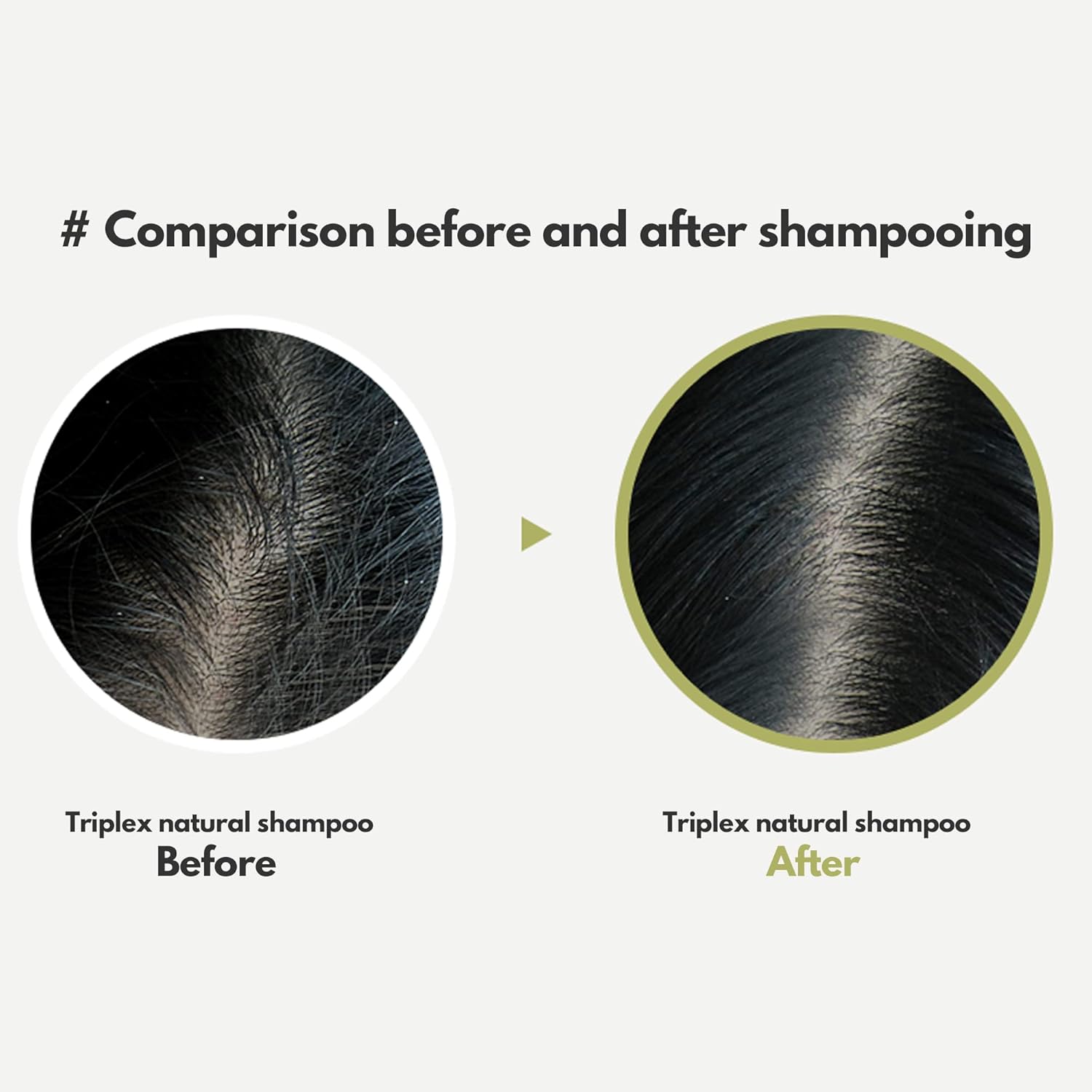 La'Dor Triplex 3 Deep Cleansing Shampoo For Dry Itchy Sensitive Scalp Dandruff W/Tea Tree Lemon Lavender Sulfate-Free Korean Hair Care 10 Fl Oz