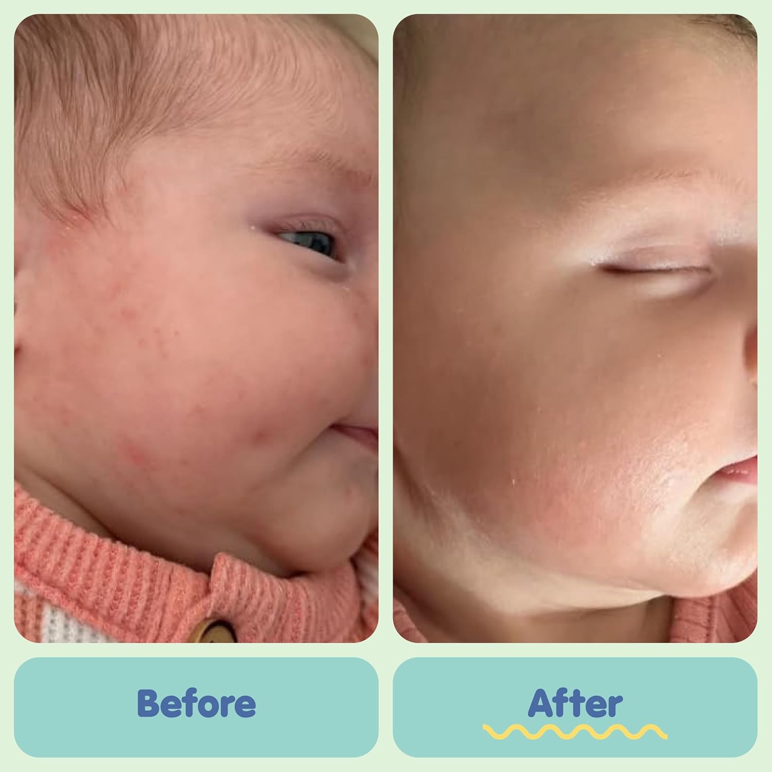 Tubby Todd All Over Ointment For Babies, Multi-Purpose Baby Eczema Cream For Sensitive Skin, Dry Skin, Rash, Irritation - 2 Pack Bundle - 8 Oz - Fragrance-Free