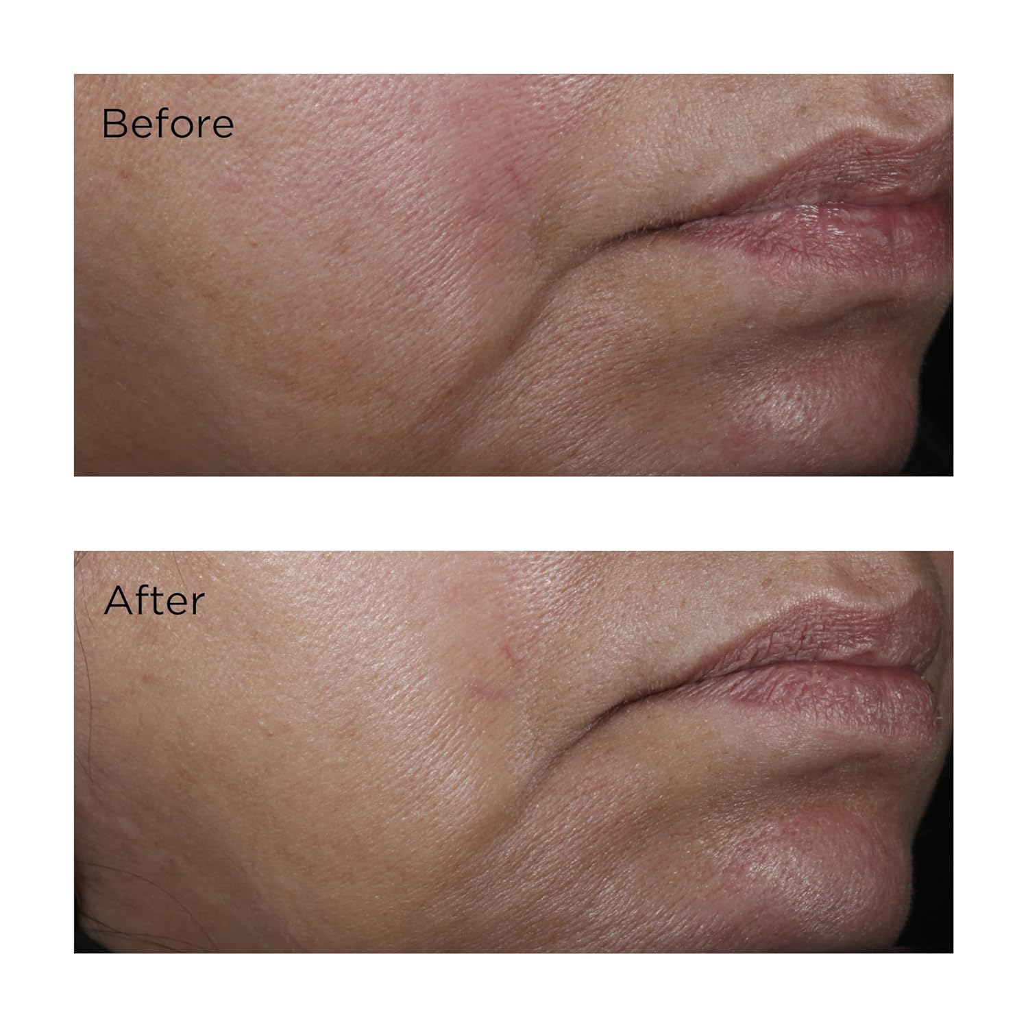 No:Rinse Intensive Pore Minimizing Toner, 4 Fl. Oz. : Beauty & Personal Care