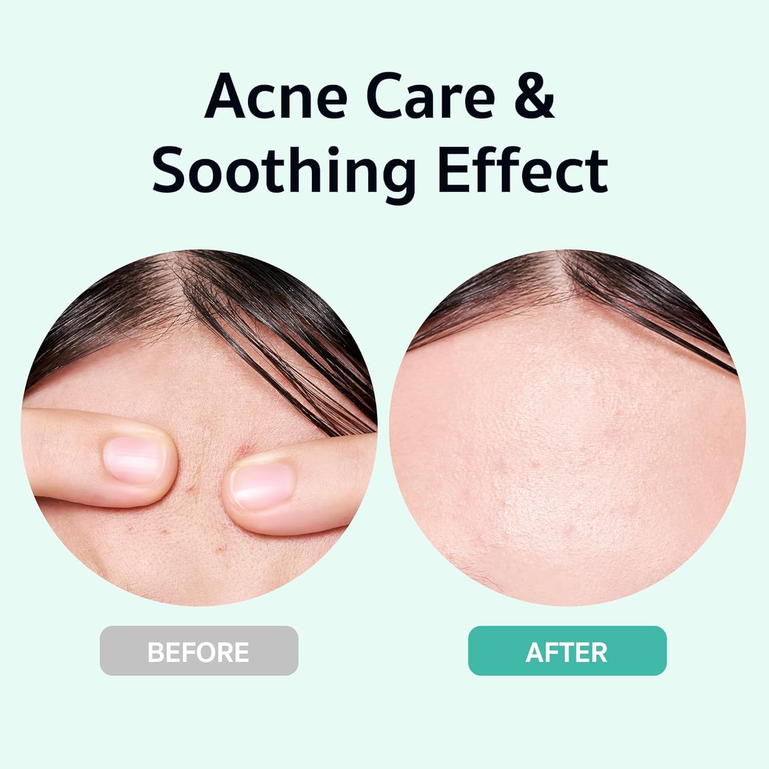 Bring Green X Netflix Squid Game Edition Zinc Teca Serum 25Ml | Calming Serum For Skin Soothing & Oil Control | Includes Free Gonggi Tossing Game As Seen In Squid Game : Beauty & Personal Care