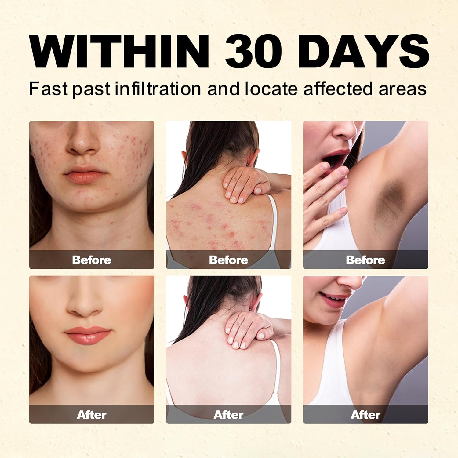 Bee Venom Cream, All-Body Skin Treatment, Natural Skin Moisturizer, New Bee Venom Skin Cream For All Types : Beauty & Personal Care