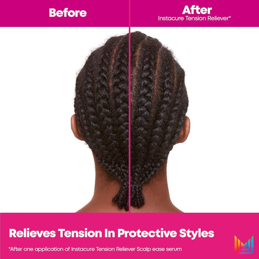 Matrix Instacure Tension Reliever Leave-In Scalp Serum | Moisturizes Dry, Irritated Scalp | Cools Tension In Braids, Protective & Tight Hairstyles | Packaging May Vary | 6.8 Fl. Oz. | Vegan