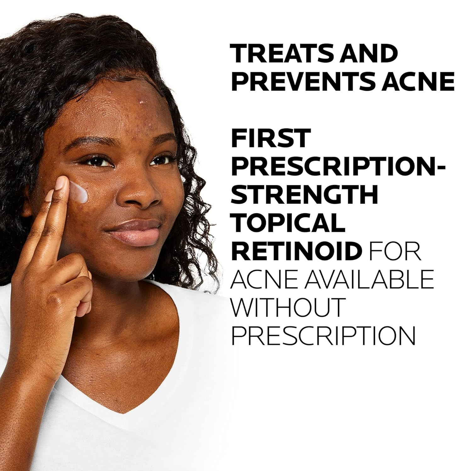 La Roche-Posay Effaclar Adapalene Gel 0.1% Acne Treatment | Retinoid Acne Cream | Acne Medication | Acne Gel For Blackheads & Whiteheads | Oil Free | Helps Clear And Prevent Acne & Clogged Pores : Beauty & Personal Care