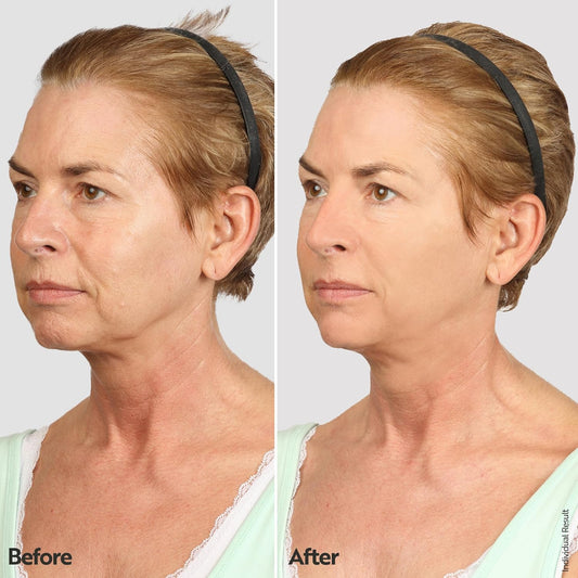 M. Asam Vino Gold 24H Facial Cream (1.69 Fl Oz)- 24H Day Cream & Night Moisturizer Against Lines & Wrinkles, Protection Against Skin Aging, Anti-Aging, Vegan Facial Care, Skincare For Women