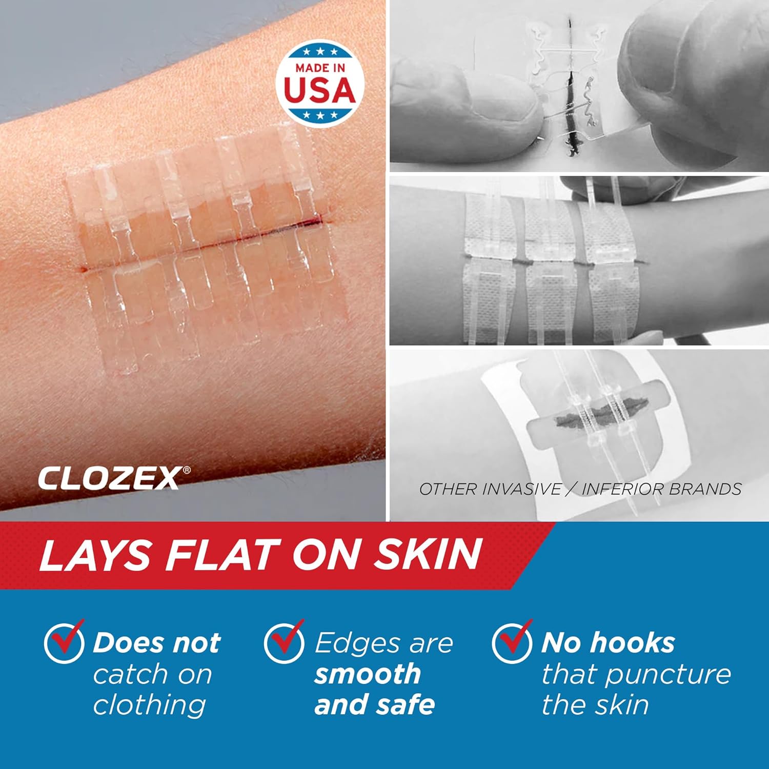 Clozex Emergency Laceration Closures - Repair Wounds Without Stitches. Fda Cleared Fsa Hsa Eligible Skin Closure Device For 2 Individual Wounds Or Combine For Total Length Of 2 Inches