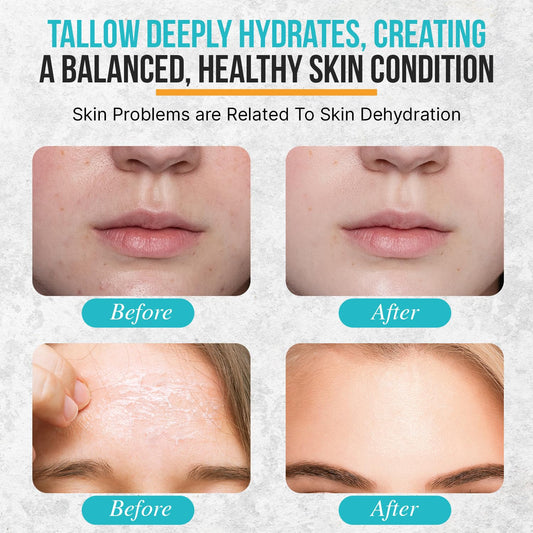 Herd & Honey Whipped Tallow Balm - Organic Tallow And Honey Balm For Face, Lips And Body, Unscented 100% Grass Fed Beef Tallow For Skin, Fast Absorbing, Non-Greasy Tallow Face Moisturizer, 2Oz