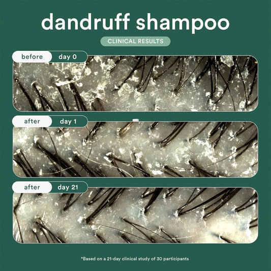 Verb® Dandruff Shampoo - For Gentle Cleansing And Clinical Strength Dandruff Relief With 3% Salicylic Acid, 8 Oz