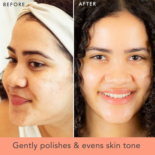 Face Scrub And Face Wash, Gentle Exfoliating, Cleansing Facial Scrub Exfoliator, Natural & Organic Ingredients