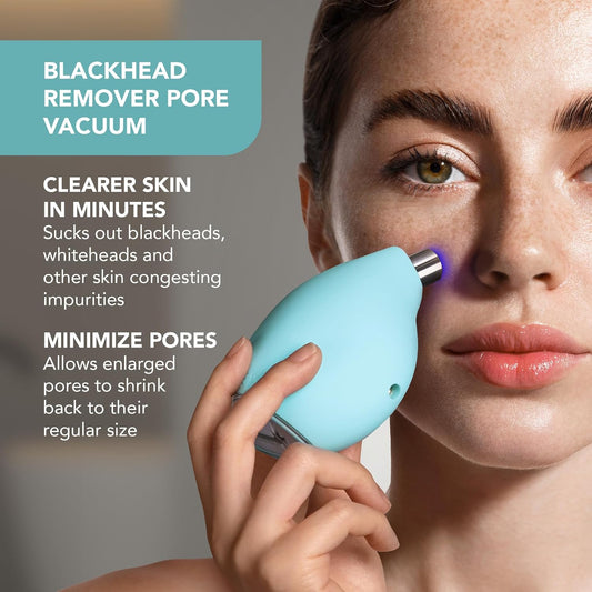 Foreo Kiwi Whitehead & Blackhead Remover Tool, Facial Blackhead Remover Vacuum For Face & Nose, Pore Remover & Pimple Popper, Quick & Effective Device With Anti-Blemish Light