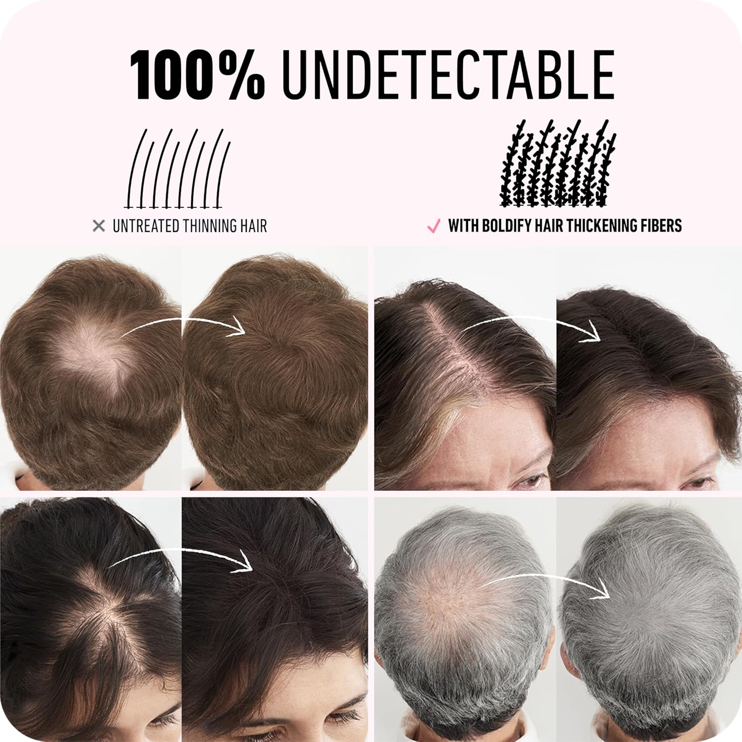 Boldify Hair Fibers (28G) - Fill In Thinning And Fine Hair For An Instantly Fuller, Thicker Look - 14 Shades For Women & Men - Dark Gray : Beauty & Personal Care