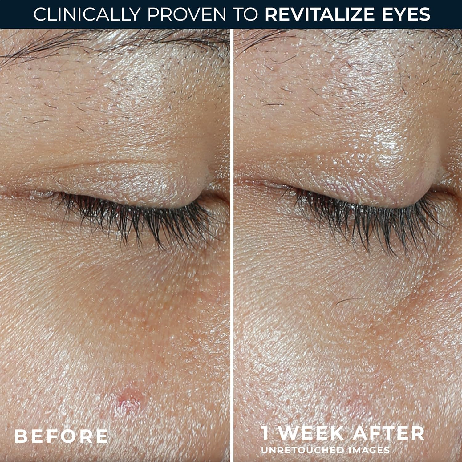 Roc Multi Correxion Revive + Glow 10% Active Vitamin C Serum For Face, Daily Anti-Aging Wrinkle And Skin Tone Skin Care Treatment, Brightening Serum, 1 Fluid Ounce : Beauty & Personal Care