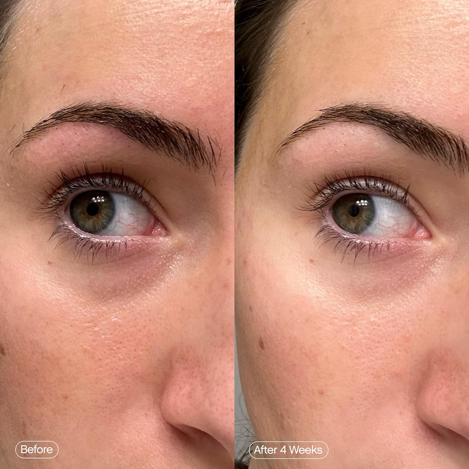 Topicals Faded Brightening Under Eye Masks | Patches To Depuff, Hydrate, Brighten And Cool | Reduce Dark Circles And Fine Lines | Contains Kojic Acid, Caffeine And Niacinamide (Set Of 6) : Beauty & Personal Care