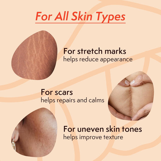 Nature Spell Stretch Mark Oil For Women, Vegan Body Oil For Stretch Marks, Scars & Uneven Skin Tone, 3.38 Fl Oz