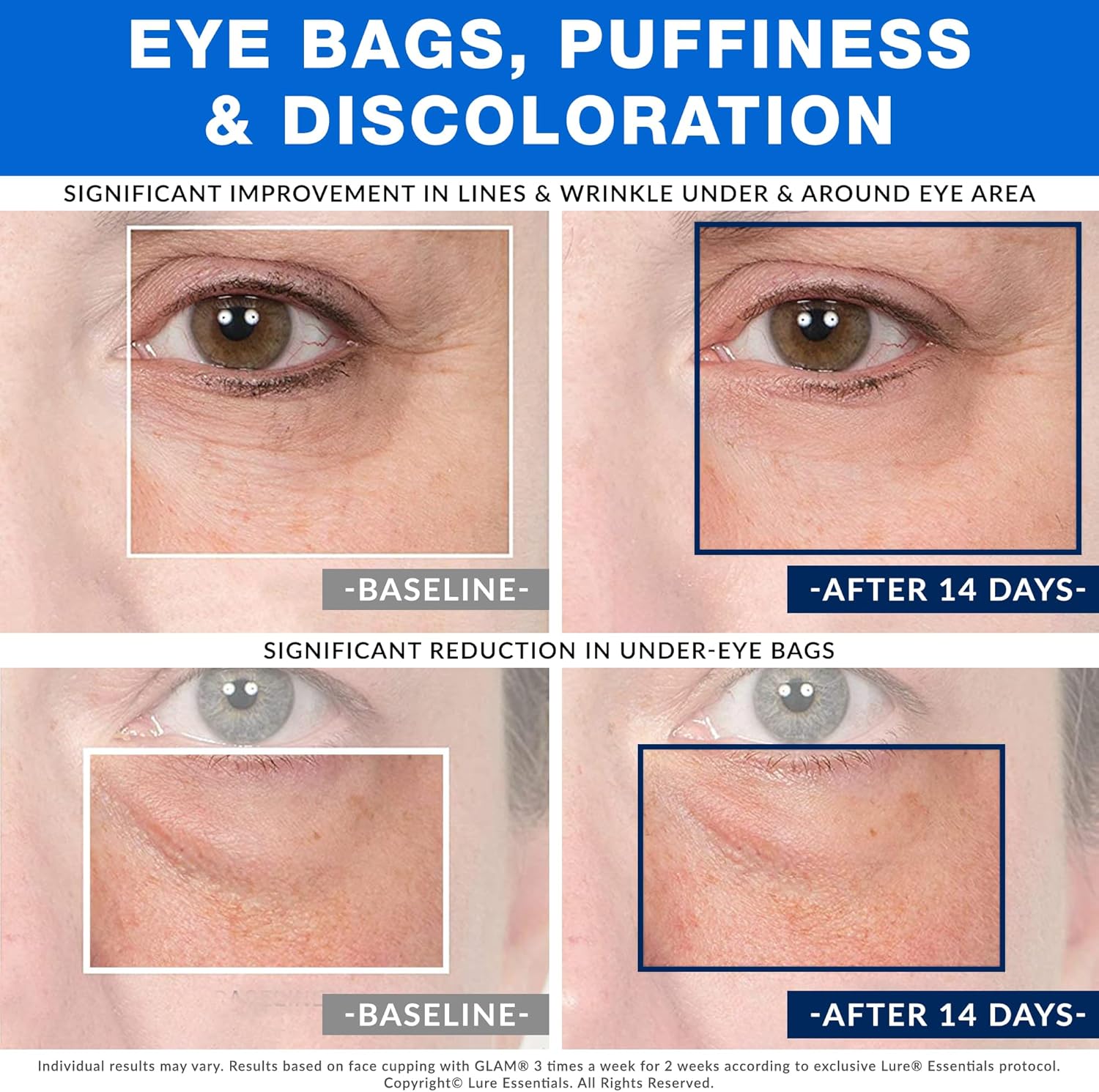 Glass Facial Suction Cup Size 2 Medium Cup For Facelift Wrinkles Lymphatic Massage : Health & Household