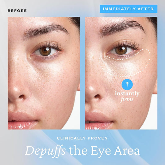 Belif Aqua Bomb Lifting Eye Gel | Retinol + Collagen + Peptide For Firming & Plumping | Hyaluronic Acid For Glowy Hydration | Niacinamide For Dark Circles | Korean Skin Care