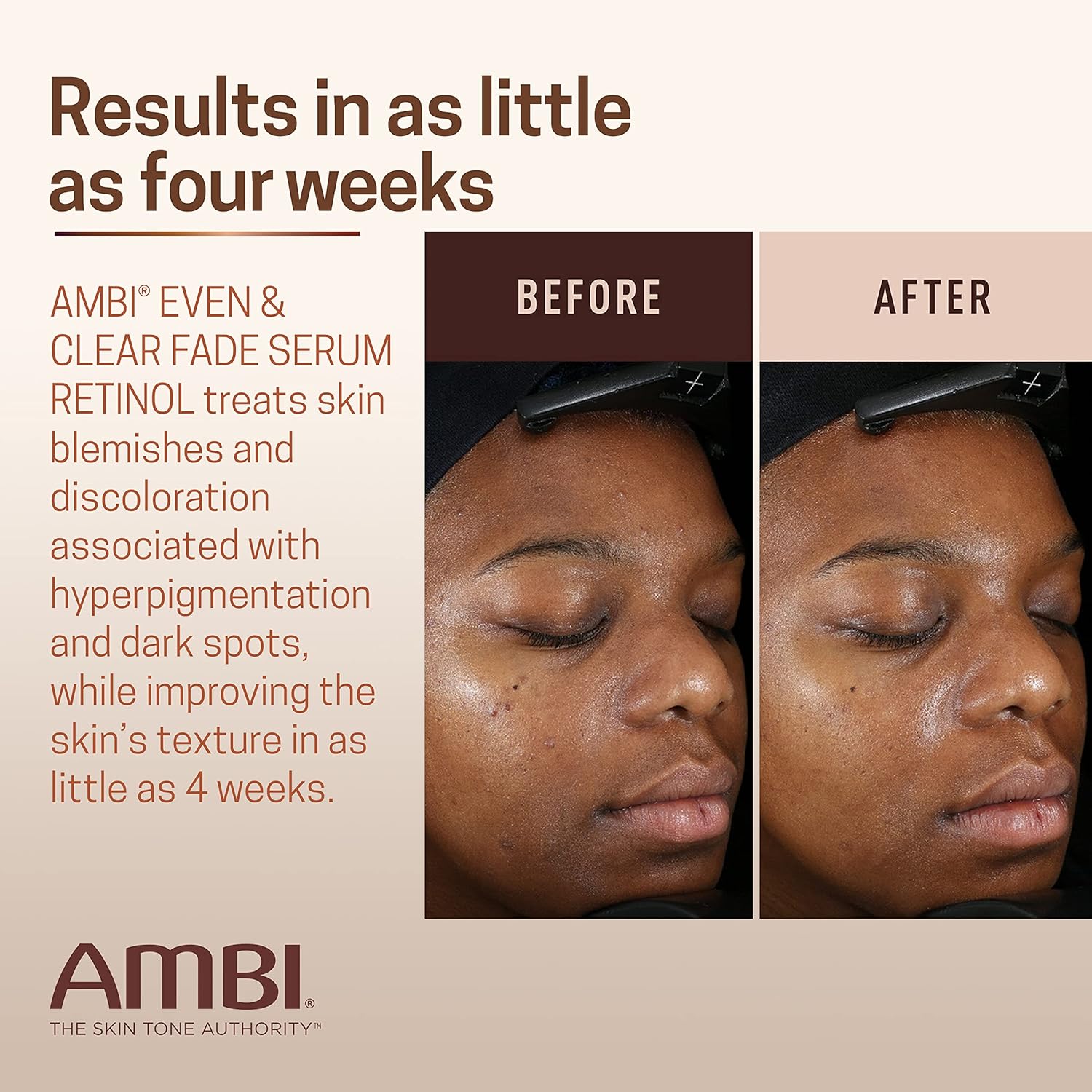 Ambi Even & Clear Fade Serum, Hyperpigmentation Treatment, Hydroquinone-free, Dark Spot Corrector, Results In As Little As 4 Weeks, Retinol, Hyaluronic Acid, Niacinamide, Ceramides, 1 Fl Oz : Beauty & Personal Care