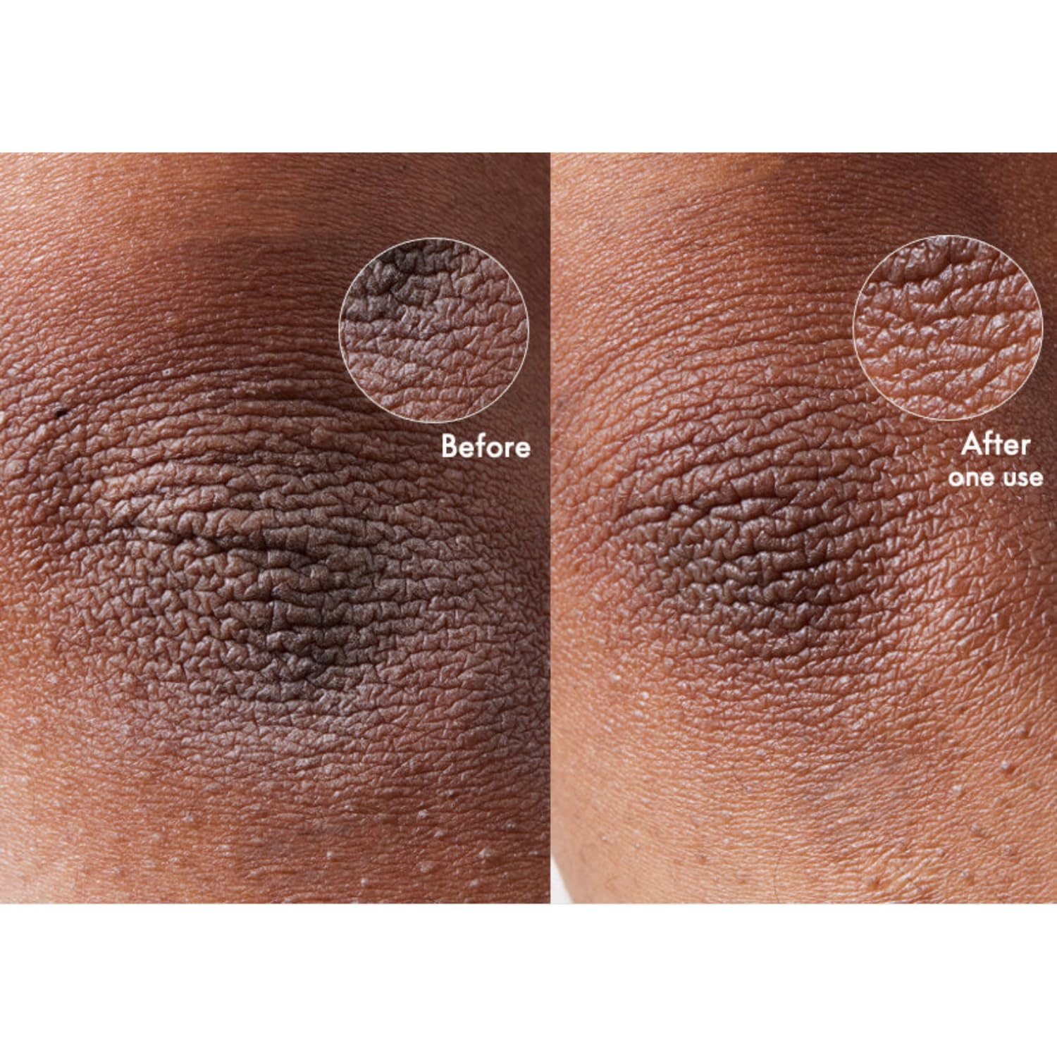 Lanolips 101 Dry Skin Super Cream - Body Cream & Face Moisturizer - Whipped Body Butter For Dry Skin - Triple Lanolin, Sweet Almond Oil, Shea Butter & Vitamin E Infused Body Care (2.02 Oz) : Beauty & Personal Care