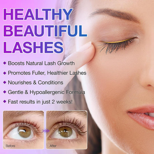 Eyelash Growth Serum, Advanced Lash Serum For Eyelash Growth, Women Eyelash Serum - Promotes Longer, Fuller And Thicker Lashes In A Month (5Ml)