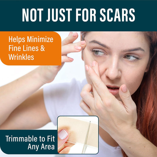 Nuvadermis Silicone Scar Tape For Surgical Scars - 120" X 1.5" Roll - Extra Long Medical Grade Silicone Scar Tape For C-Section, Tummy Tuck, Keloid, And Surgical Scars - Reusable Tape Strips - 1 Pack