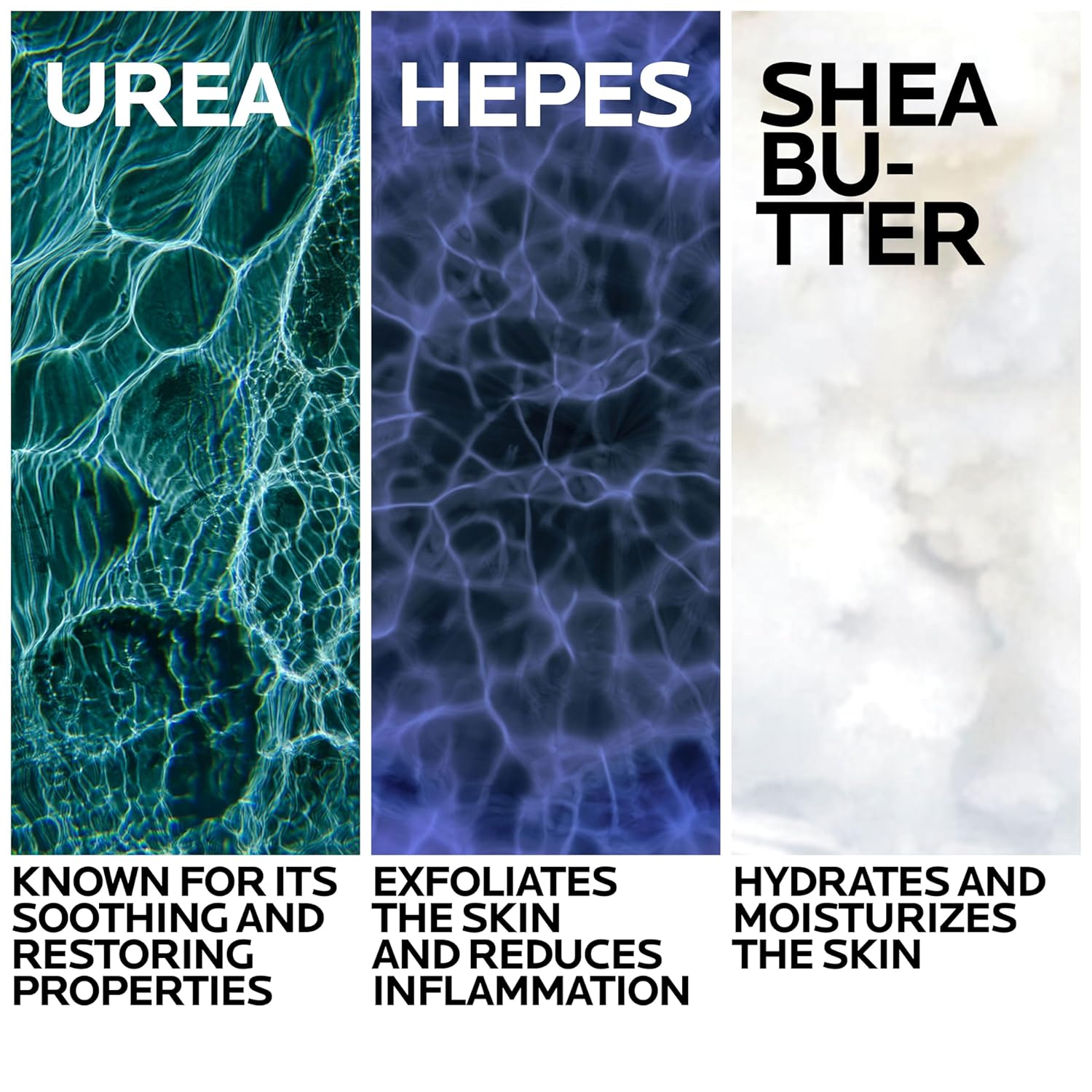 La Roche-Posay Lipikar Urea 10% Roughness Smoothing Lotion, Body Lotion For Dry Skin With 10% Urea + Shea Butter + Allantoin, Rough And Bumpy Skin Lotion, Softens & Smooths Skin With 1 Application : Beauty & Personal Care