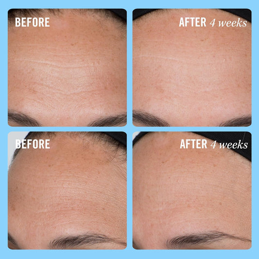 First Aid Beauty - Firming Collagen Cream With Peptides & Niacinamide, Ultra-Rich Plumping Moisturizer, Hydrates & Visibly Firms, Non-Comedogenic, Safe For Sensitive Skin, 3.5 Oz