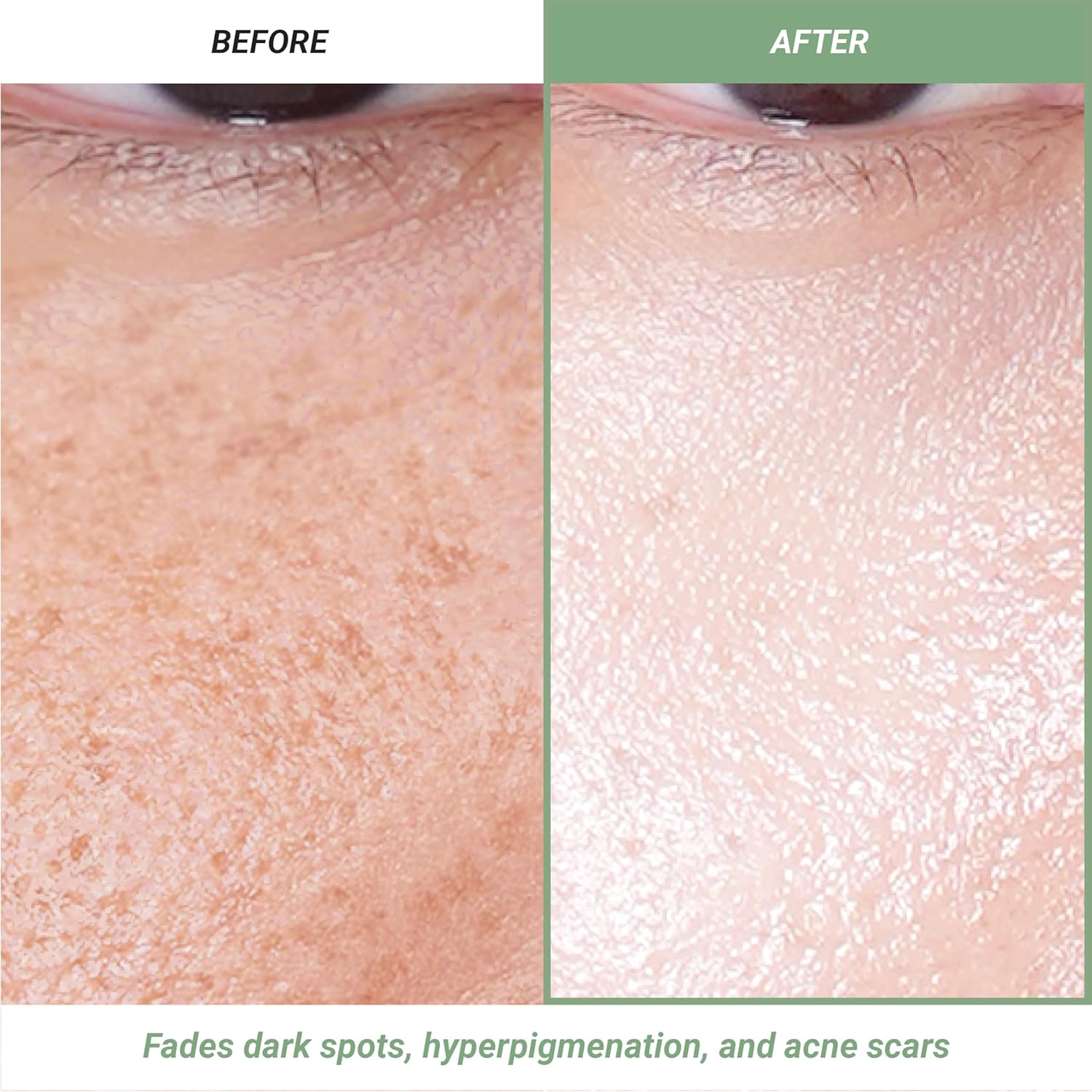 Meebak Korean Vitamin C Serum | Brightening Dark Spot Remover | Soothing Anti Aging & Skin Brightening W/Centella Asiatica, Panthenol, & Adenosine : Beauty & Personal Care